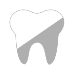 ホワイトニング